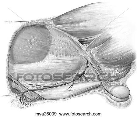 Superficial inguinal ring, canine View Large Illustration Stock Illustration - Superficial inguinal ring, canine. Fotosearch