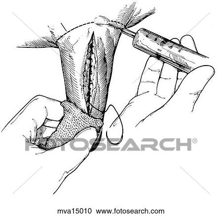 Clipart - Teat laceration, bovine. Fotosearch