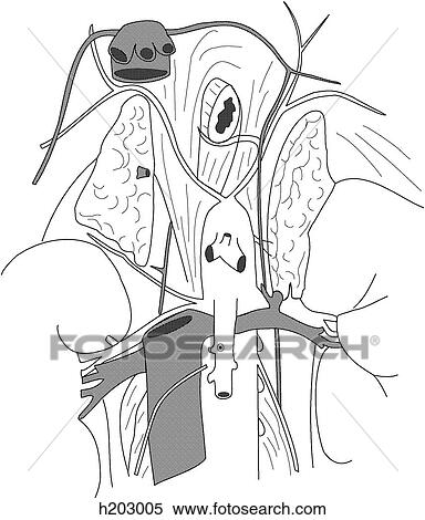 Stock Illustration - Arteries & veins of kidneys & suprarenal glands. Fotosearch