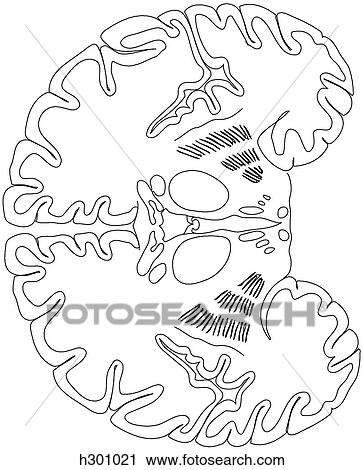 Brain, coronal section View Large Illustration Clip Art - Brain, coronal section. Fotosearch