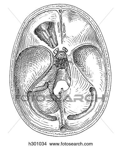 Stock Illustration - Dura mater, meninges. Fotosearch