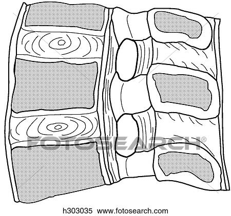 Lumbar spine w/ligaments, median segment View Large Illustration Stock Illustration - Lumbar spine w/ligaments, median segment. Fotosearch