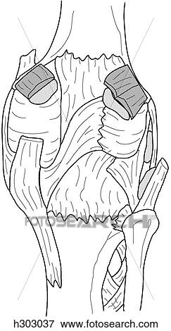 Muscles, tendons, and ligaments of knee View Large Illustration Stock Illustration - Muscles, tendons, and ligaments of knee. Fotosearch