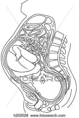 Stock Illustration - Pregnancy: Gravid uterus w/term fetus. Fotosearch