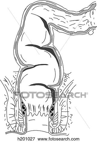 Stock Illustration - Rectum and anal canal. Fotosearch