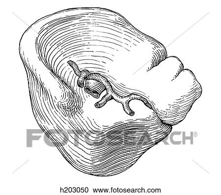 Clipart - Spleen, visceral surface. Fotosearch