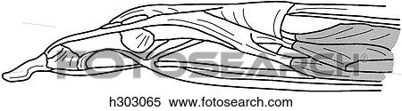 Tendon attachments of finger View Large Illustration Stock Illustration - Tendon attachments of finger. Fotosearch