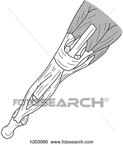 Tendon attachments of finger View Large Illustration Stock Illustration - Tendon attachments of finger. Fotosearch
