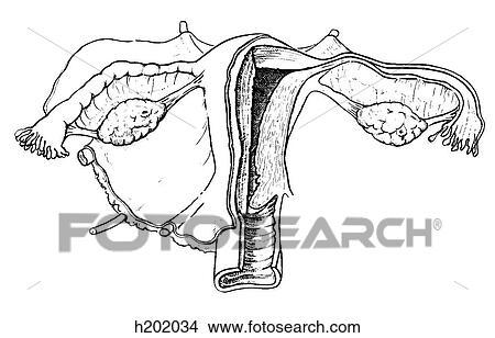 Stock Illustration - Uterus, ovaries, ligaments. Fotosearch