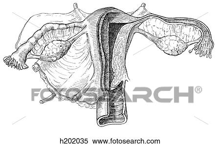 Uterus, ovaries, ligaments View Large Illustration Stock Illustration - Uterus, ovaries, ligaments. Fotosearch