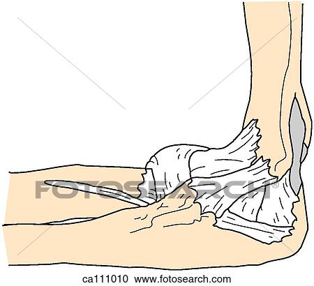 Clipart - Elbow, bones and ligaments. Fotosearch
