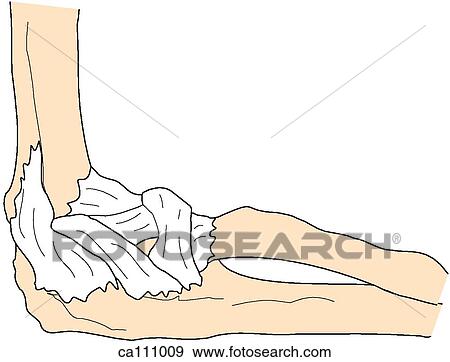 Elbow, bones and ligaments View Large Illustration Stock Illustration - Elbow, bones and ligaments. Fotosearch
