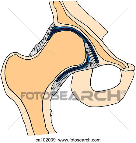 Stock Illustration - Hip joint, cross section. Fotosearch