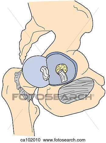 Hip joint, disarticulated View Large Illustration Clipart - Hip joint, disarticulated. Fotosearch