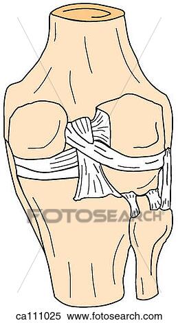 Stock Illustration - Knee, bones and ligaments. Fotosearch