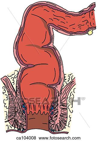 Rectum and anal canal View Large Illustration Stock Illustration - Rectum and anal canal. Fotosearch