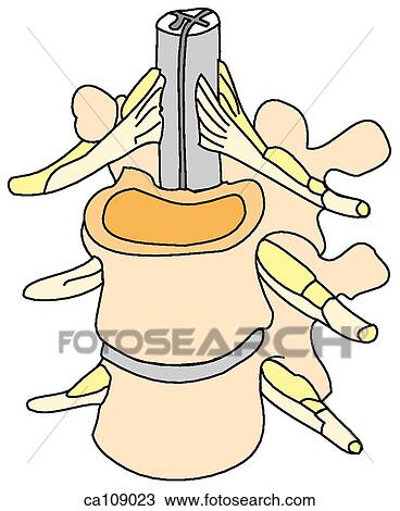 Drawing - Vertebrae with spinal cord and nerve roots. Fotosearch