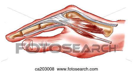 手 提示 関係 の Lumbrical そして Interosseous 筋肉 へ Metacarpophalangeal そして Interphalangeal 接合箇所 斧 イラスト Ca3008 Fotosearch