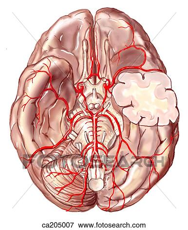 Stock Illustration - Arteries of brain. Fotosearch