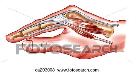 Hand showing relationship of lumbrical and interosseous muscles to metacarpophalangeal and interphalangeal joint axes View Large Illustration Stock Illustration - Hand showing relationship of lumbrical and interosseous muscles to metacarpophalangeal and interphalangeal joint axes. Fotosearch