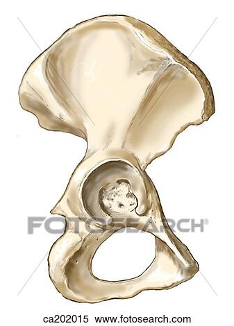 Stock Illustration - Hip bone. Fotosearch