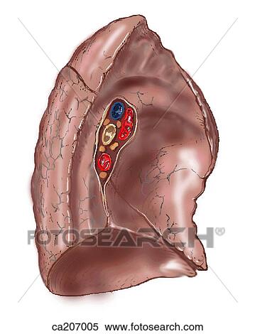 Left lung View Large Illustration Stock Illustration - Left lung. Fotosearch