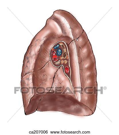 Right lung View Large Illustration Stock Illustration - Right lung. Fotosearch