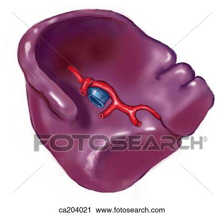 Clip Art - Spleen with splenic vessels. Fotosearch