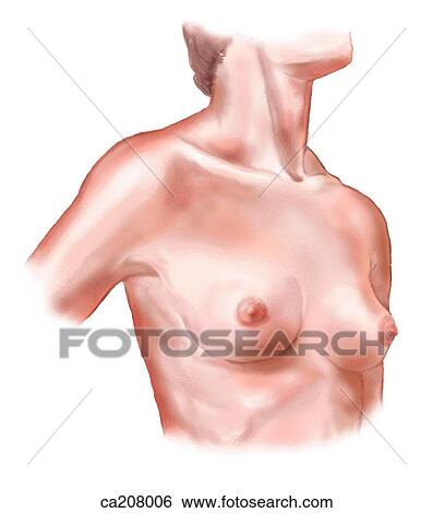Surface anatomy of mammary glands View Large Illustration Stock Illustration - Surface anatomy of mammary glands. Fotosearch
