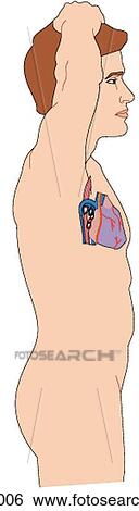 Stock Illustration - Location of heart and great vessels within thorax with respect to surface anatomy, right lateral view. Fotosearch
