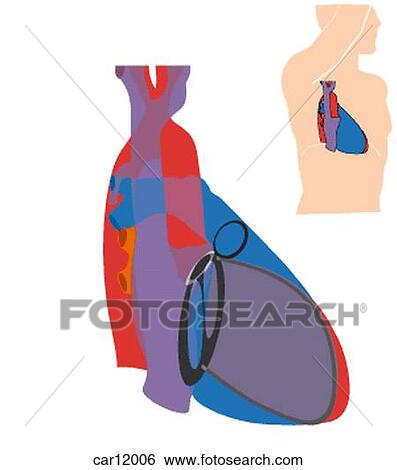 Stock Illustration - Right anterior oblique radiogram showing great vessels, chambers and intraventricular septum, right anterolateral. Fotosearch