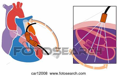 Schematic illustration showing ultrasound procedure when examining a heart View Large Illustration Stock Illustration - Schematic illustration showing ultrasound procedure when examining a heart. Fotosearch