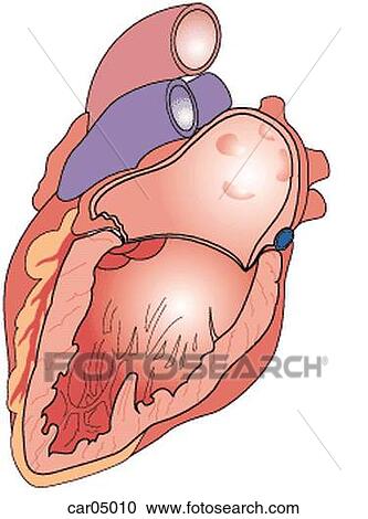 Clipart - Section through left atrium and ventricle with mitral valve cut away.. Fotosearch