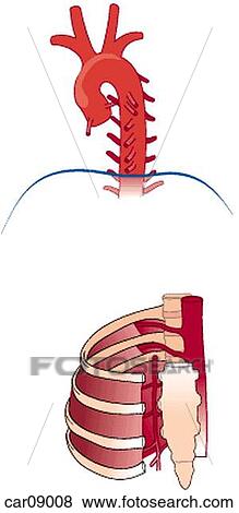 Thoracic aorta including arch. Ribcage showing intercostal muscles and arteries and internal thoracic artery. View Large Illustration Stock Illustration - Thoracic aorta including arch. Ribcage showing intercostal muscles and arteries and internal thoracic artery.. Fotosearch