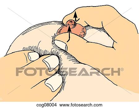 Breast palpation technique View Large Illustration Stock Illustration - Breast palpation technique. Fotosearch