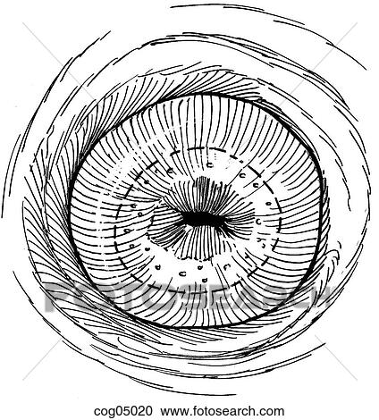 Cervix and transformation zone View Large Illustration Clipart - Cervix and transformation zone. Fotosearch