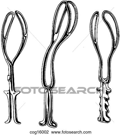 Forceps, obstetric View Large Illustration Drawing - Forceps, obstetric. Fotosearch