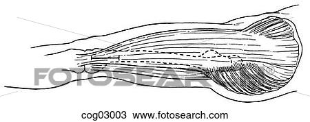 Drawing - Harvesting fascia lata, step 1. Fotosearch