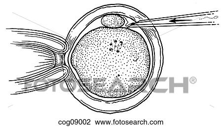 In-Vitro fertilization View Large Illustration Drawing - In-Vitro fertilization. Fotosearch