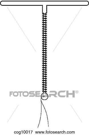 Intrauterine Devices, TCu 200B View Large Illustration Stock Illustration - Intrauterine Devices, TCu 200B. Fotosearch