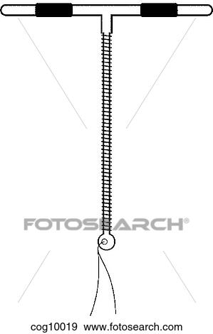 Intrauterine Devices, TCu 380A View Large Illustration Stock Illustration - Intrauterine Devices, TCu 380A. Fotosearch
