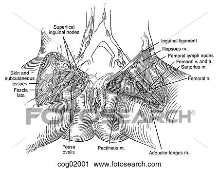Lymph nodes, inguinal-femoral View Large Illustration Clip Art - Lymph nodes, inguinal-femoral. Fotosearch