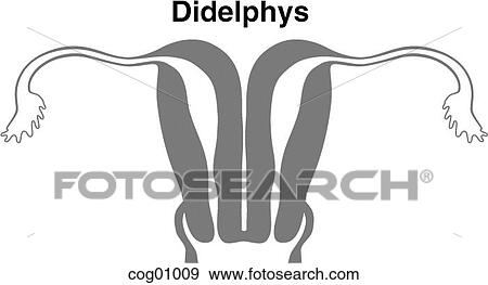 Mullerian duct anomaly, didelphys View Large Illustration Stock Illustration - Mullerian duct anomaly, didelphys. Fotosearch