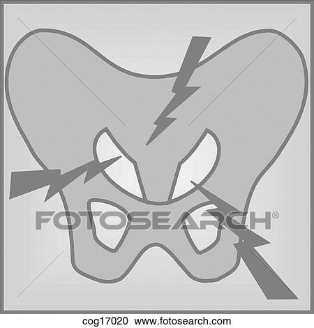 Pelvic pain View Large Illustration Clipart - Pelvic pain. Fotosearch