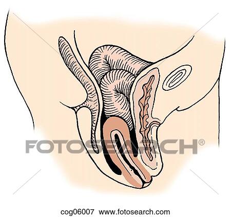 Pelvic relaxation, third degree View Large Illustration Stock Illustration - Pelvic relaxation, third degree. Fotosearch