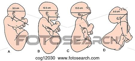 Clipart - Presentation, breech, cranial diameters. Fotosearch