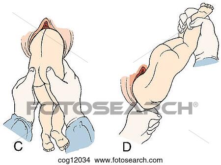 Presentation, breech, extraction, step 2 View Large Illustration Stock Illustration - Presentation, breech, extraction, step 2. Fotosearch