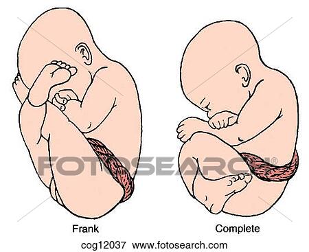 Presentation, breech, full View Large Illustration Stock Illustration - Presentation, breech, full. Fotosearch