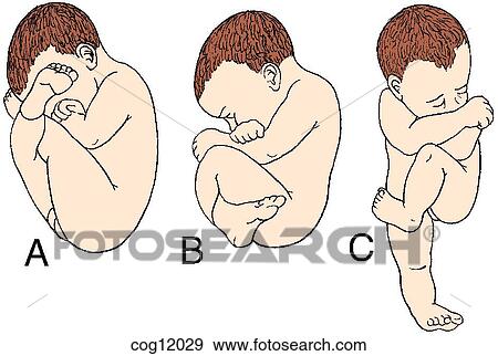 Stock Illustration - Presentation, breech. Fotosearch