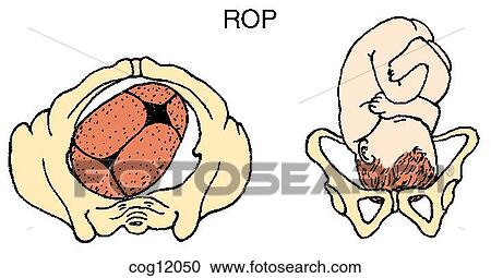 Clipart - Presentation, vertex, ROP position. Fotosearch